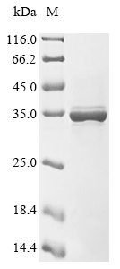 SDS-PAGE