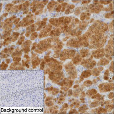 Валидация AntibodySystem RHD87203