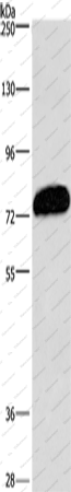 Вестерн-блоттинг, CDCP1, клетки PC3