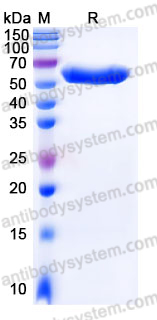 EHJ44301, SDS-PAGE