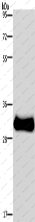 Вестерн-блоттинг, FHL3, скелетная мышь
