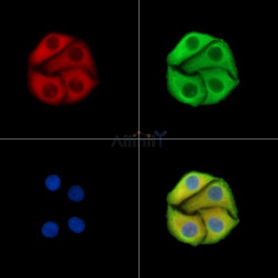 Валидация Affinity DF15256 - 11538