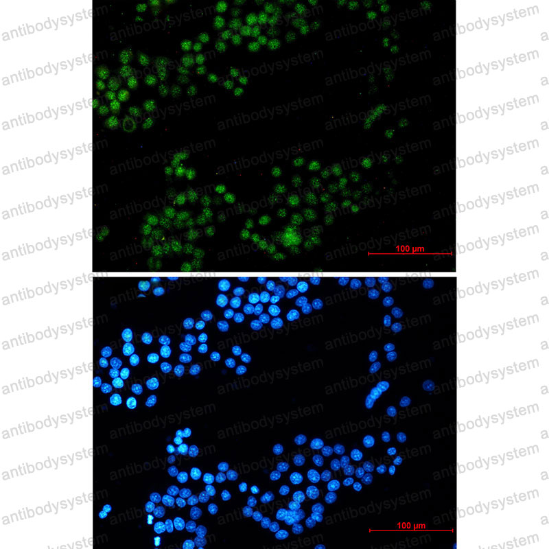 Валидация IF - AntibodySystem RHJ08101
