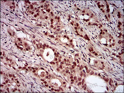 Валидация AntibodySystem RHB05003 (260)