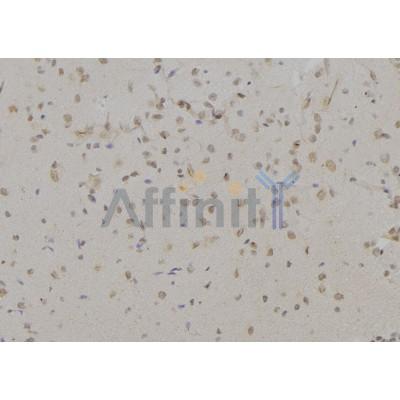 Валидация Affinity DF6938 - 18551