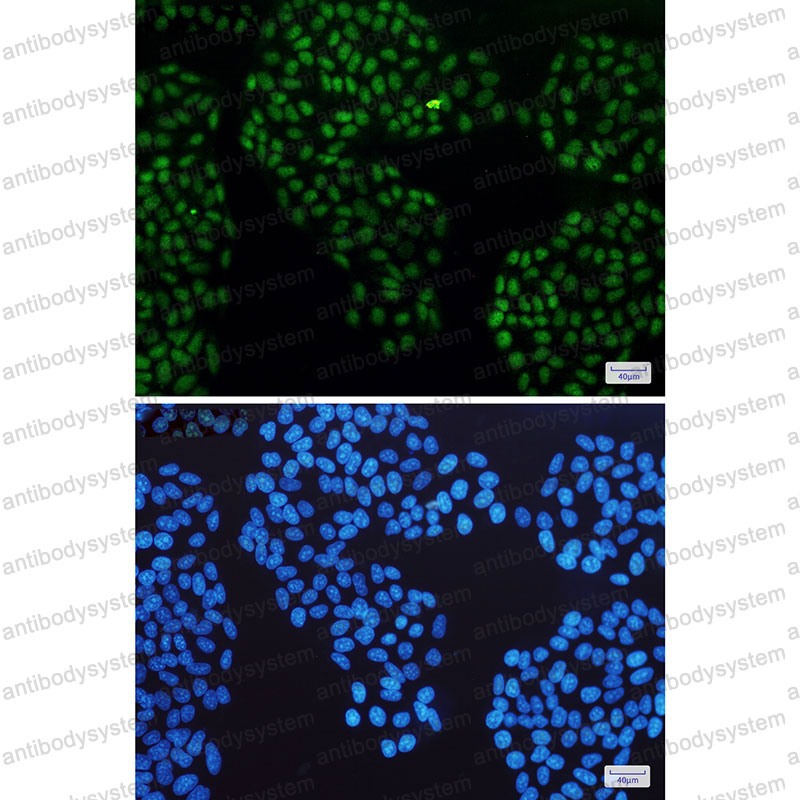 Валидация IF - AntibodySystem RMC06801