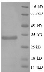 SDS-PAGE