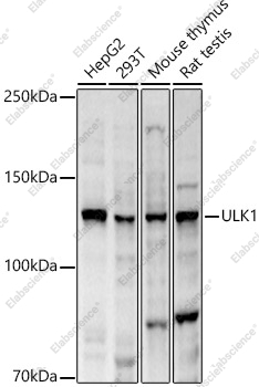 Вестерн-блоттинг, ULK1, различные лизаты