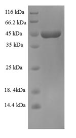 SDS-PAGE