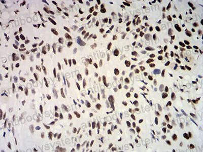 Валидация AntibodySystem RHC03209 (560)