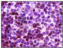 Валидация AntibodySystem RHE42902