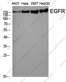 Вестерн-блоттинг, EGFR, различные клеточные линии