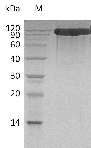 SDS-PAGE