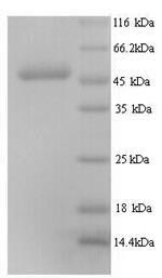 SDS-PAGE