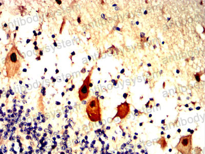 Валидация AntibodySystem RHF04701