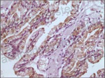 Валидация AntibodySystem RHC39302