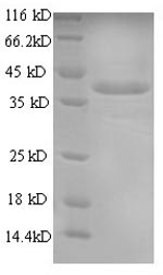 SDS-PAGE