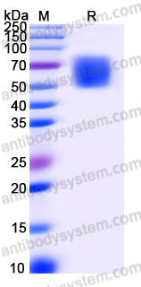 EHK98702, SDS-PAGE
