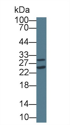 12754