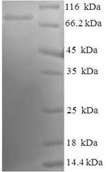 SDS-PAGE
