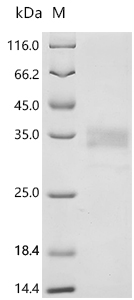 SDS-PAGE