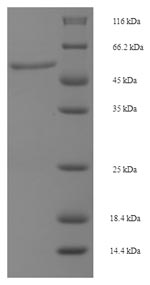 SDS-PAGE