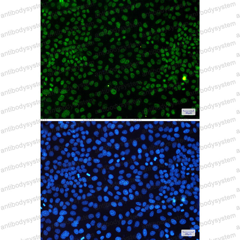 Валидация IF - AntibodySystem RHE78701