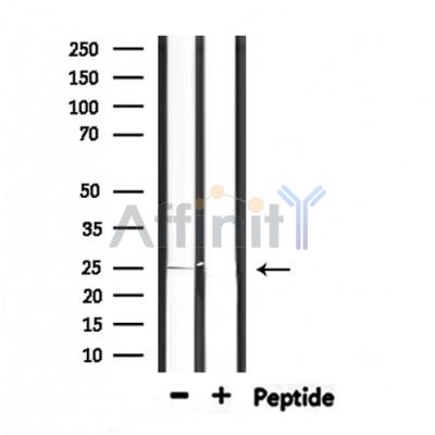 Валидация Affinity DF6765 - 18332