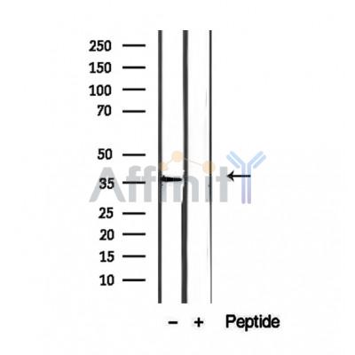 Валидация Affinity DF12393 - 6873