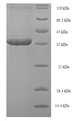 SDS-PAGE