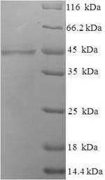 SDS-PAGE