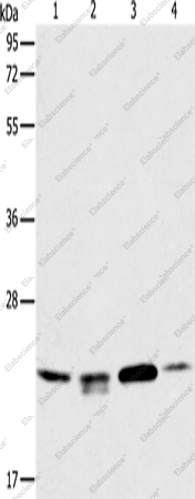 Вестерн-блоттинг, PRDX2, клетки 293T, HeLa, PC3 и ткань рака печени человека