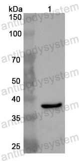 Валидация AntibodySystem PHB84701