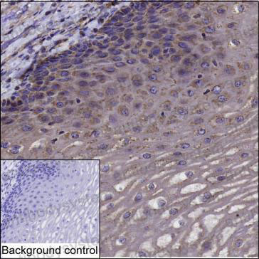Валидация AntibodySystem RHJ69702