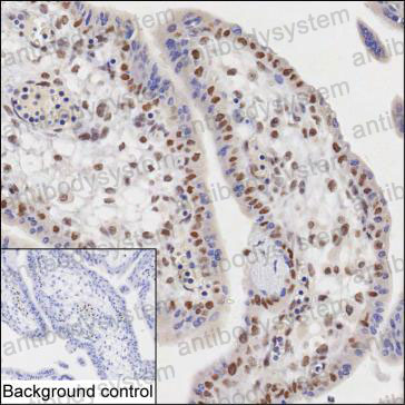Валидация AntibodySystem RHD74303