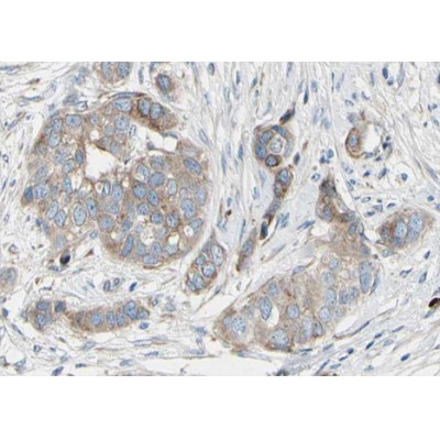 Валидация Affinity AF3472 - 1992