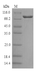 SDS-PAGE