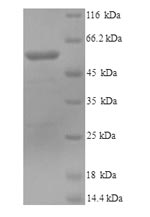 SDS-PAGE
