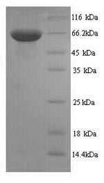 SDS-PAGE