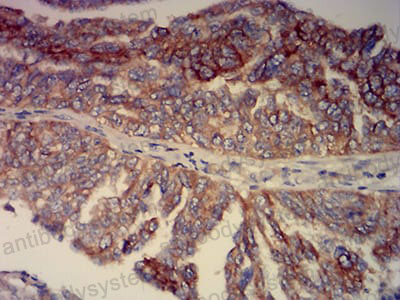 Валидация AntibodySystem RHE79003 (2331)