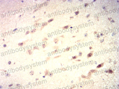 Валидация AntibodySystem RHG13208 (2854)