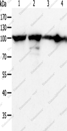 Вестерн-блоттинг, HSP90B1, клетки HeLa, Jurkat, NIH/3T3 и ткань рака печени человека