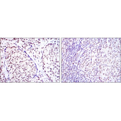 Валидация Affinity BF0153 - 5161