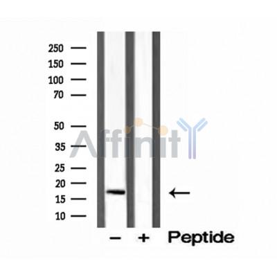 Валидация Affinity DF12192 - 6431