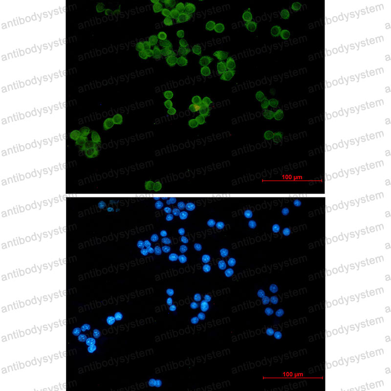 Валидация IF - AntibodySystem RHF61801