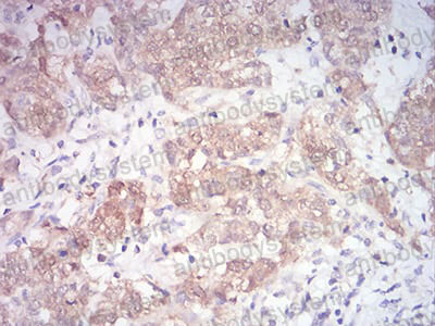 Валидация AntibodySystem RHE48804 (2204)