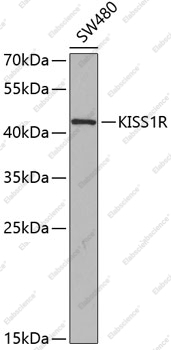 Вестерн-блоттинг, KISS1R, клетки SW480