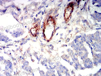 Валидация AntibodySystem RHD45801