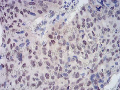 Валидация AntibodySystem RHG43405 (2940)