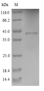 SDS-PAGE